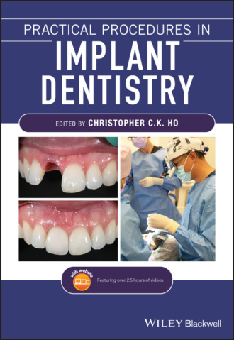 Группа авторов. Practical Procedures in Implant Dentistry