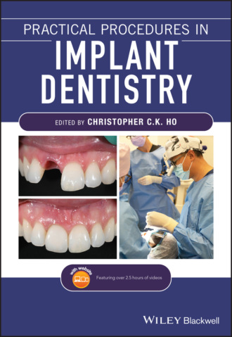 Practical Procedures in Implant Dentistry. Группа авторов