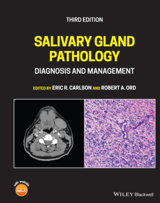 Группа авторов. Salivary Gland Pathology