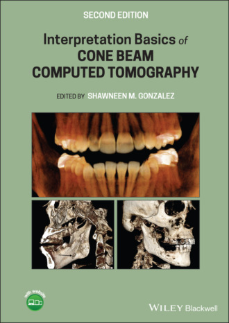 Группа авторов. Interpretation Basics of Cone Beam Computed Tomography