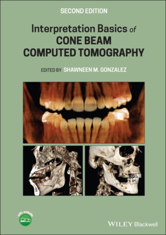 Interpretation Basics of Cone Beam Computed Tomography. Группа авторов