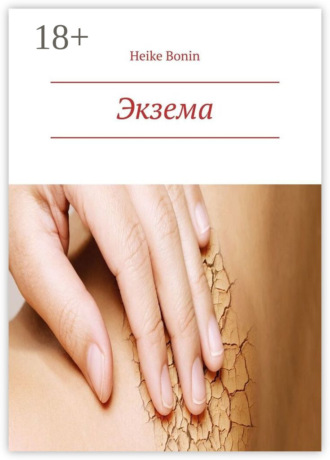 Экзема. 