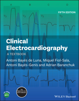 Miquel Fiol-Sala. Clinical Electrocardiography