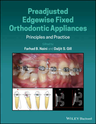 Группа авторов. Preadjusted Edgewise Fixed Orthodontic Appliances