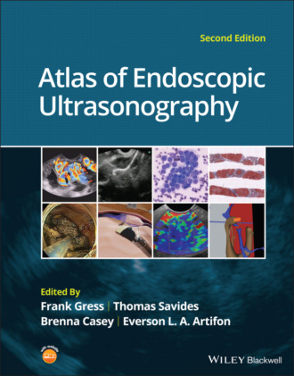 Группа авторов. Atlas of Endoscopic Ultrasonography