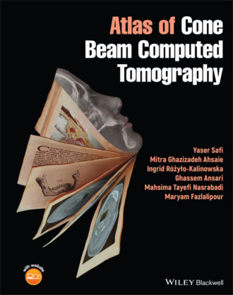 Ghassem Ansari. Atlas of Cone Beam Computed Tomography