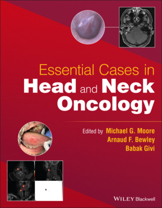 Группа авторов. Essential Cases in Head and Neck Oncology