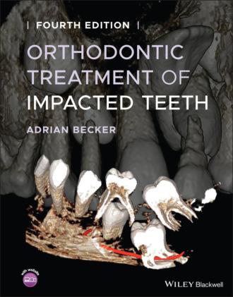 Adrian Becker. Orthodontic Treatment of Impacted Teeth