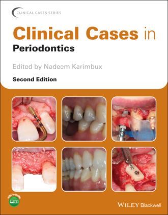 Группа авторов. Clinical Cases in Periodontics