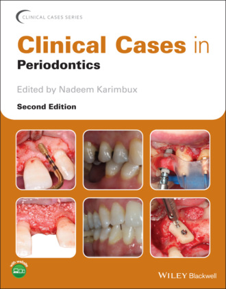 Clinical Cases in Periodontics. Группа авторов