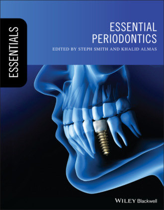 Essential Periodontics. Группа авторов