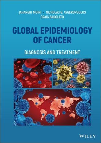 Jahangir Moini. Global Epidemiology of Cancer