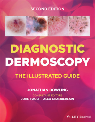 Группа авторов. Diagnostic Dermoscopy
