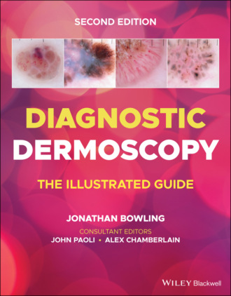 Diagnostic Dermoscopy. Группа авторов