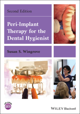 Susan S. Wingrove. Peri-Implant Therapy for the Dental Hygienist