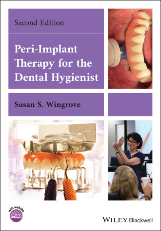 Peri-Implant Therapy for the Dental Hygienist. Susan S. Wingrove