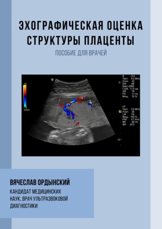 Вячеслав Ордынский. Эхографическая оценка структуры плаценты