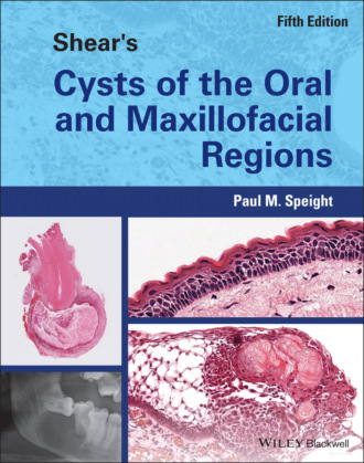Paul M. Speight. Shear's Cysts of the Oral and Maxillofacial Regions