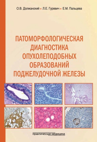 Е. М. Пальцева. Патоморфологическая диагностика опухолеподобных образований поджелудочной железы. Руководство для врачей