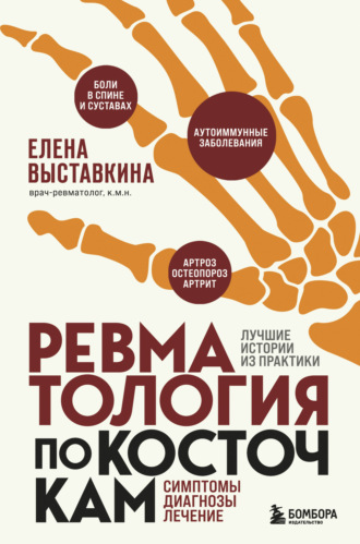 Елена Выставкина. Ревматология по косточкам. Симптомы, диагнозы, лечение