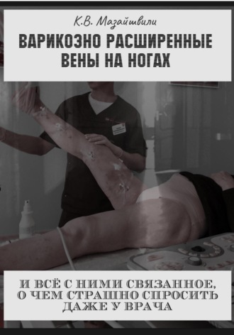 Константин Витальевич Мазайшвили. Варикозно расширенные вены на ногах и всё с ними связанное, о чём страшно спросить даже у врача