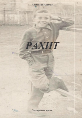 Рахит. 