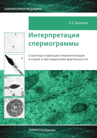Е. Е. Брагина. Интерпретация спермограммы. Структура и функция сперматозоидов в норме и при нарушении фертильности