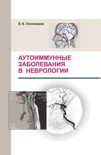 В. В. Пономарев. Аутоиммунные заболевания в неврологии