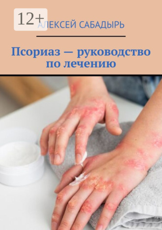 Псориаз – руководство по лечению. 