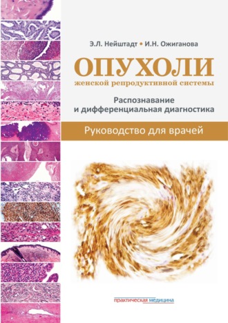 Э. Л. Нейштадт. Опухоли женской репродуктивной системы. Распознавание и дифференциальная диагностика. Руководство для врачей