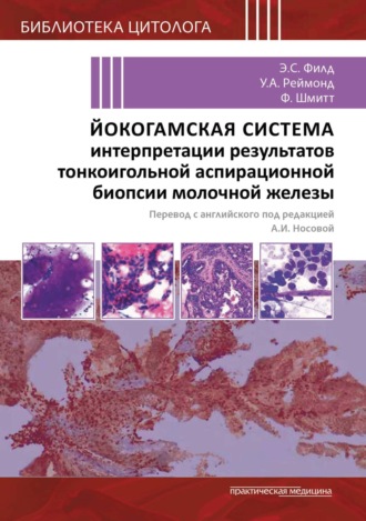 Коллектив авторов. Йокогамская система интерпретации результатов тонкоигольной аспирационной биопсии молочной железы
