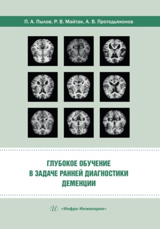 Глубокое обучение в задаче ранней диагностики деменции. 