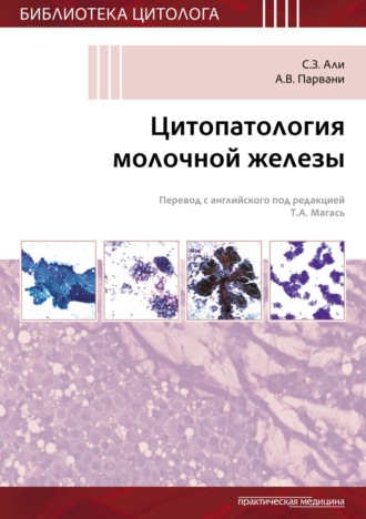 С. Али. Цитопатология молочной железы