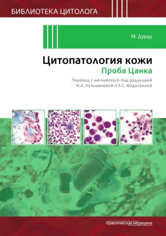 М. Дурду. Цитопатология кожи. Проба Цанка
