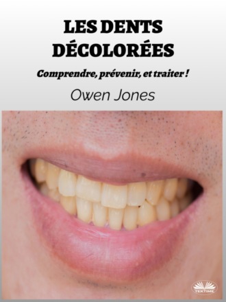 Les Dents Décolorées. 