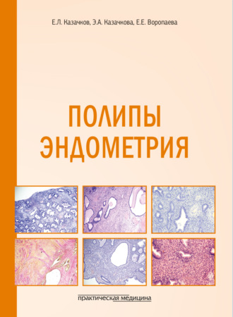 Е. Л. Казачков. Полипы эндометрия. Учебное пособие