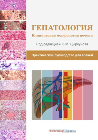 Гепатология. Клиническая морфология печени. Практическое руководство для врачей. 