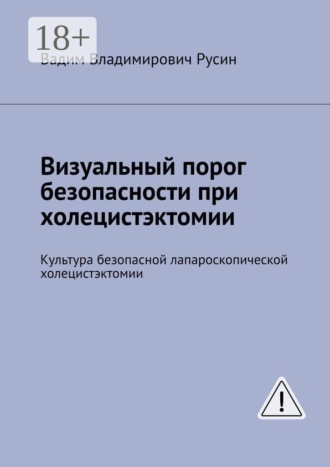 Визуальный порог безопасности при холецистэктомии. Культура безопасной лапароскопической холецистэктомии. 