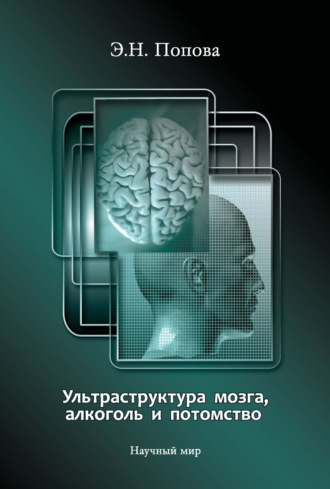 Э. Н. Попова. Ультраструктура мозга, алкоголь и потомство