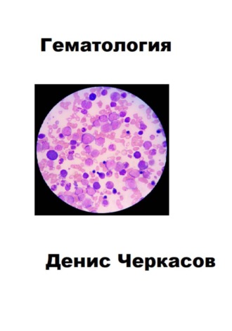 Гематология. Денис Черкасов