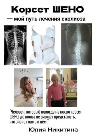 Юлия Никитина. Корсет Шено. Мой путь лечения сколиоза
