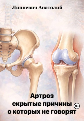Анатолий Липневич. Артроз: скрытые причины, о которых не говорят