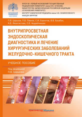 П. В. Царьков. Внутрипросветная эндоскопическая диагностика и лечение хирургических заболеваний желудочно-кишечного тракта