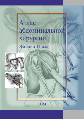 Атлас абдоминальной хирургии. Том 1. Хирургия печени, желчных путей, поджелудочной железы и портальной системы. Эмилио Итала