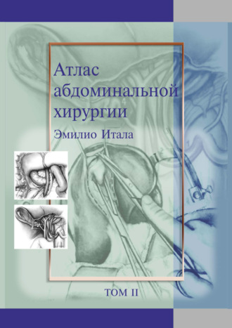 Атлас абдоминальной хирургии. Том 2. Хирургия желудка и двенадцатиперстной кишки. Эмилио Итала