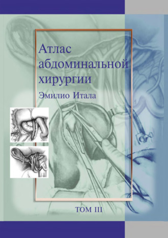 Атлас абдоминальной хирургии. Том 3. Хирургия тонкой и толстой кишки, прямой кишки и анальной области. Эмилио Итала