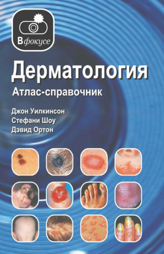 Дерматология. Атлас – справочник. Джон Уилкинсон