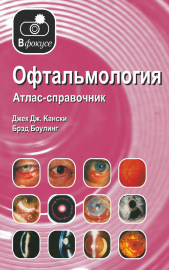 Джек Дж. Кански. Офтальмология. Атлас – справочник