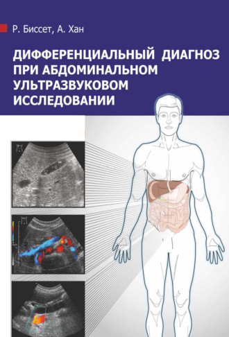 Р. А. Л. Биссет. Дифференциальный диагноз при абдоминальном ультразвуковом исследовании