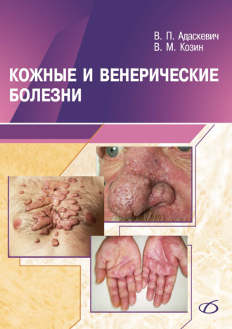 Кожные и венерические болезни. Владимир Адаскевич